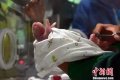  【蓝网早察】170列